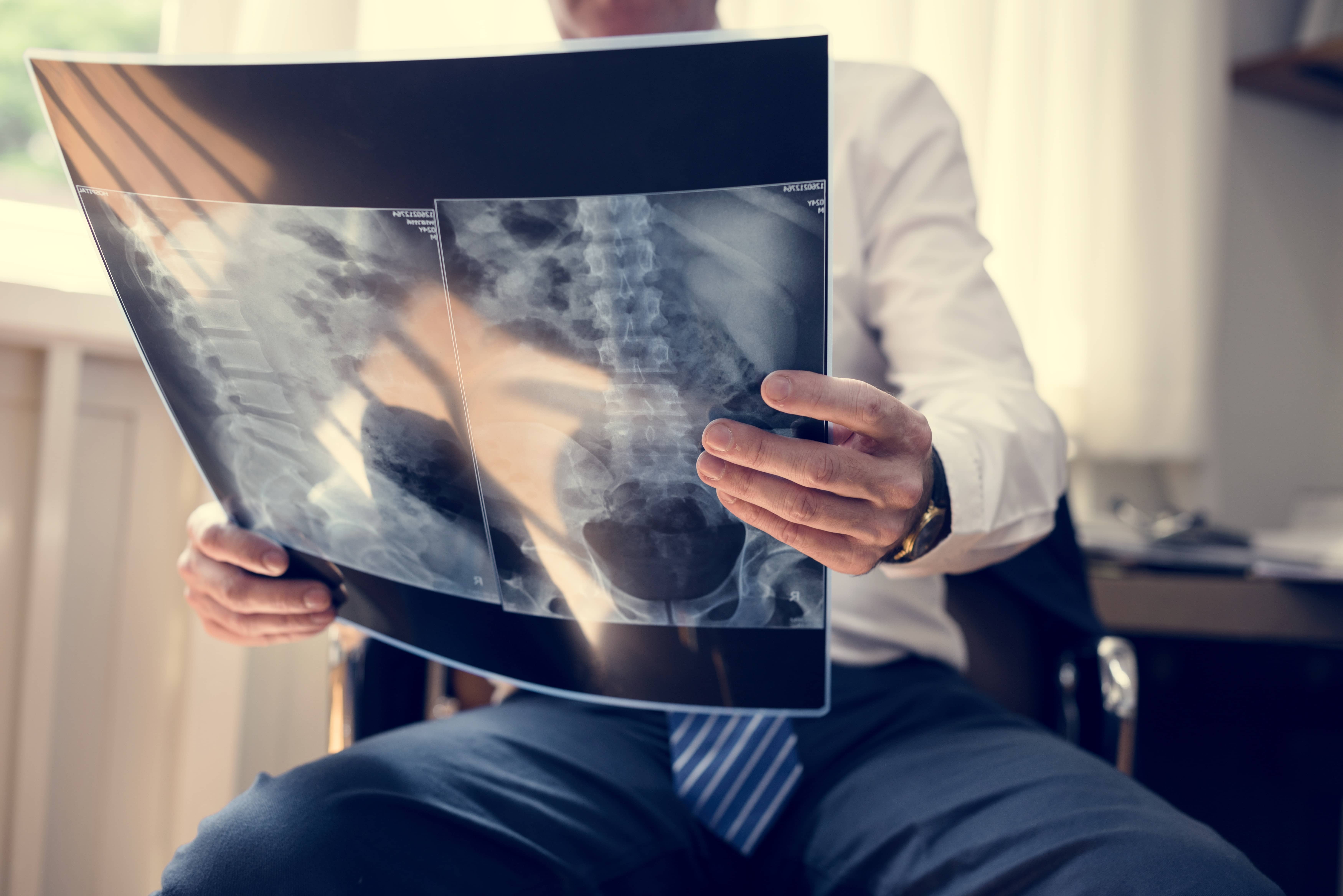 Imaging Diagnostics